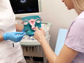 Médico con modelo anatómico de útero Conoce las formas de ayudar a tu cuerpo a sentirse mejor