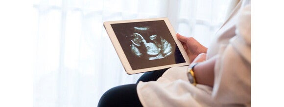 La alimentación balanceada influye en el desarrollo del bebé Mujer embarazada viendo un ultrasonido de su bebé a través de una tableta electrónica